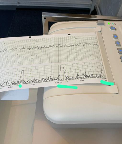 Bild zu CTG - Auswertung - Baby Forum - Allgemeine Themen