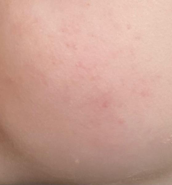 Bild zu Was ist das - Baby Forum - Allgemeine Themen