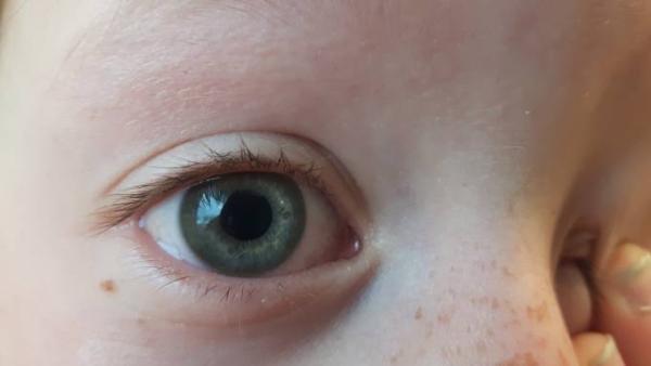 Bild zu Hilfe bei Augenfarbe deuten. - Baby Forum - Allgemeine Themen