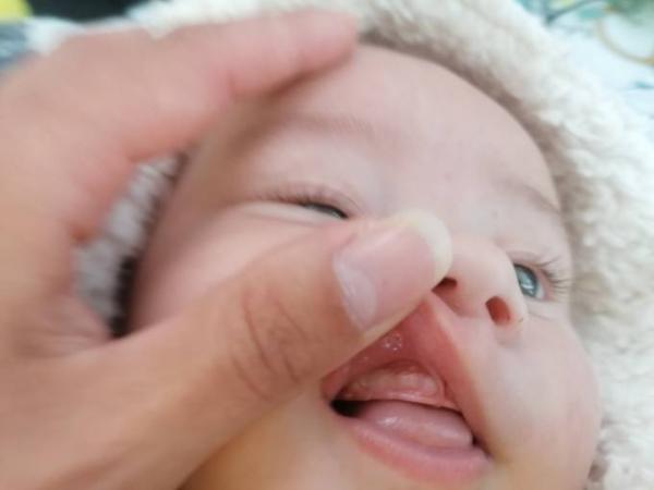 Bild zu Zahnt mein Baby? - Baby Forum - Allgemeine Themen