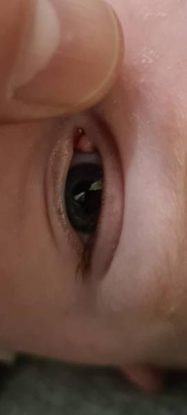 Bild zu Schwellung im Auge - Baby Forum - Allgemeine Themen
