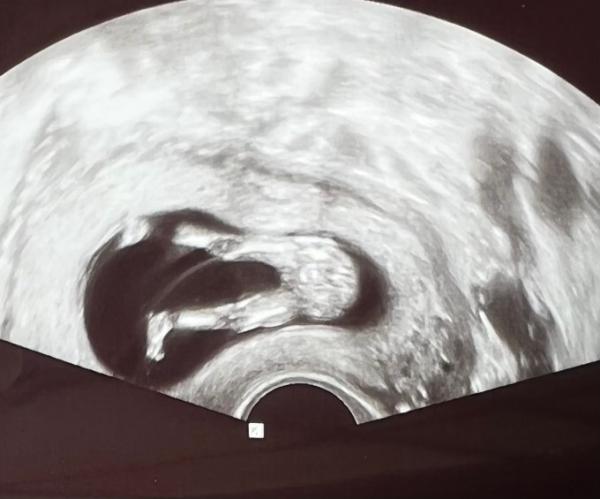 Bild zu Junge oder Mädchen? - Baby Forum - Allgemeine Themen