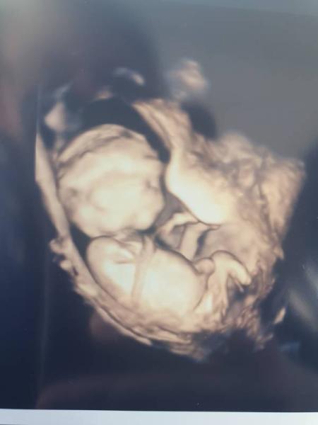 Bild zu Junge oder Mädchen? - Baby Forum - Allgemeine Themen