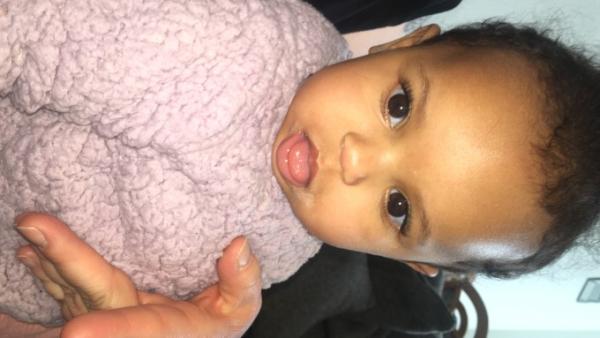 Bild zu Baby steckt seit Tagen Zunge raus - Baby Forum - Allgemeine Themen