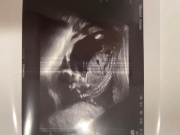 Bild zu Bitte helfen! - Baby Forum - Allgemeine Themen