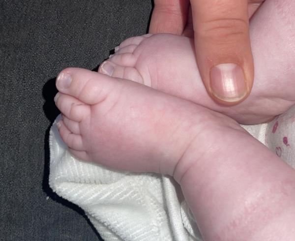 Bild zu Bläuliche Nägel - Baby Forum - Allgemeine Themen