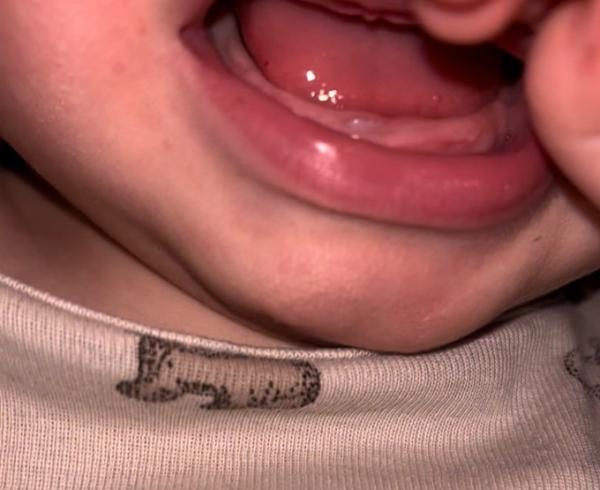 Bild zu Zahnen - Baby Forum - Allgemeine Themen