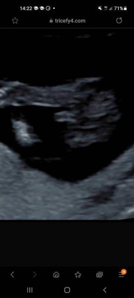 Bild zu 13 SSW Outing Geschlecht - Baby Forum - Allgemeine Themen