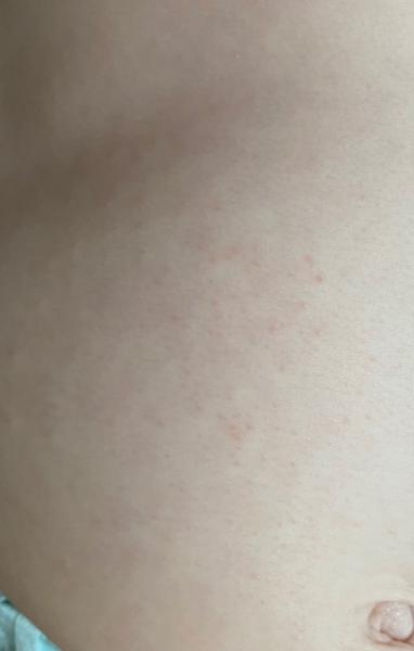 Bild zu Kennt das jemand ? - Baby Forum - Allgemeine Themen