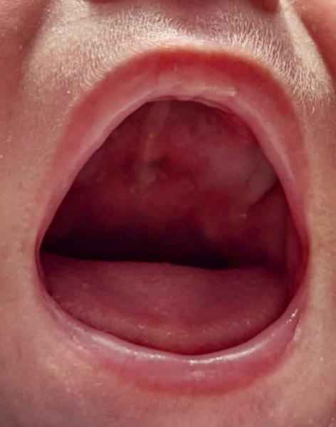 Bild zu Was ist das? - Baby Forum - Allgemeine Themen
