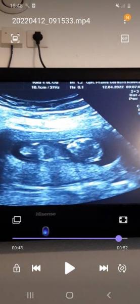 Bild zu Geschlecht erkennbar? - Baby Forum - Allgemeine Themen