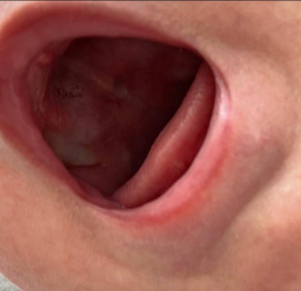 Bild zu Ist das normal? - Baby Forum - Allgemeine Themen