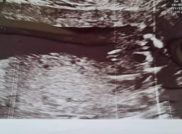 Bild zu Geschlecht Junge oder Mädchen - Baby Forum - Allgemeine Themen