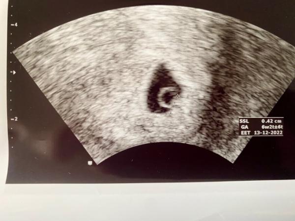 Bild zu Ramzi Methode - wer kennt sich aus ?:) - Baby Forum - Allgemeine Themen