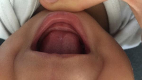 Bild zu Baby 7 und halb Monate Zähne - Baby Forum - Allgemeine Themen