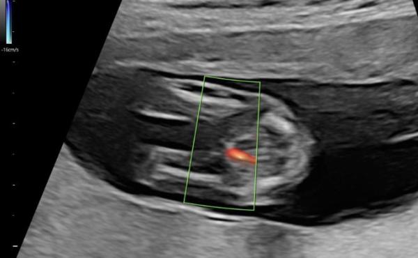 Bild zu Geschlecht - Baby Forum - Allgemeine Themen