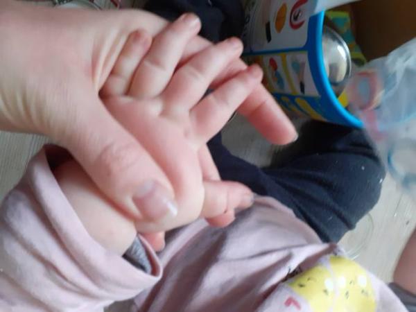 Bild zu Gerötete Hände - Baby Forum - Allgemeine Themen