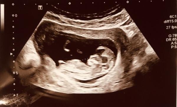 Bild zu Junge oder Mädchen? - Baby Forum - Allgemeine Themen