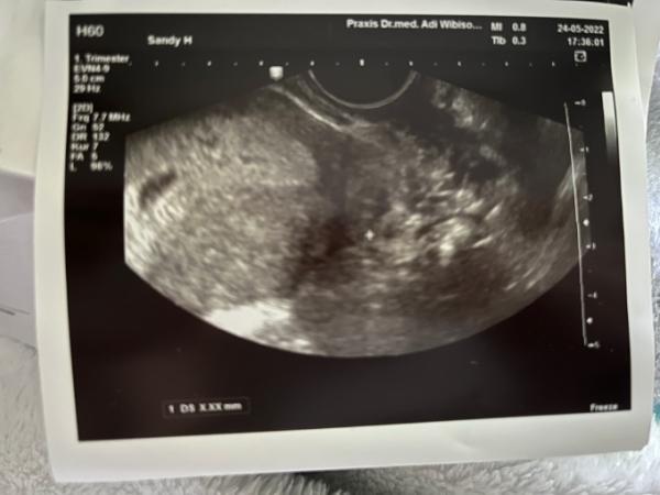 Bild zu Erkennt ihr was? - Baby Forum - Allgemeine Themen