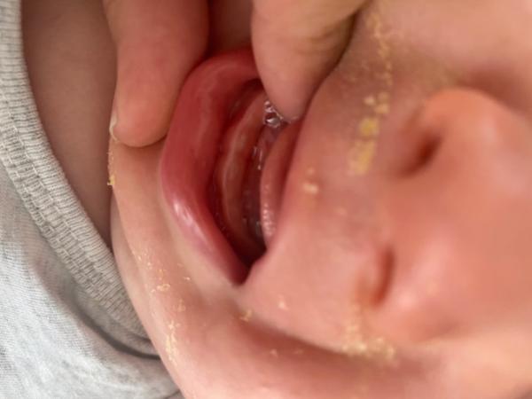 Bild zu Kleiner Mann hat es geschafft ZĂ€hne blitzen durch đ - Baby Forum - Allgemeine Themen