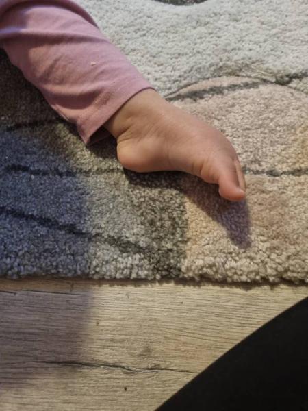 Bild zu Fußstellung - Baby Forum - Allgemeine Themen