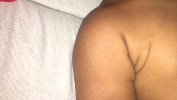 Bild zu Flecken auf der Haut ?! - Baby Forum - Allgemeine Themen