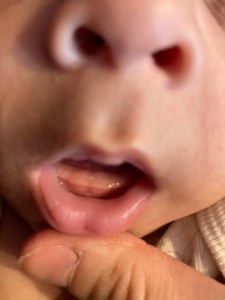 Bild zu Sind das Zähne? - Baby Forum - Allgemeine Themen
