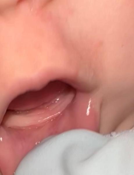 Bild zu Baby Schnupfen-zahnen? - Baby Forum - Allgemeine Themen