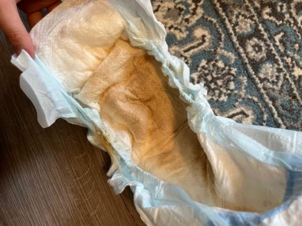 Bild zu Hilfe! Was ist das? - Baby Forum - Allgemeine Themen