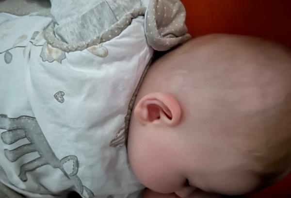 Bild zu Plattkopf - Baby Forum - Allgemeine Themen