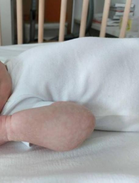 Bild zu Gelbsucht? Baby ist 17 Tage alt - Baby Forum - Allgemeine Themen