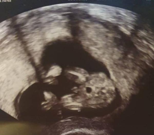 Bild zu Junge oder Mädchen - Baby Forum - Allgemeine Themen