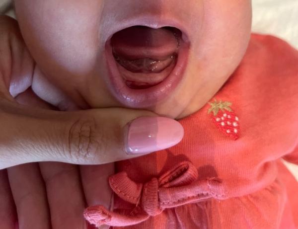 Bild zu Schießen die Zähne schon ein? - Baby Forum - Allgemeine Themen
