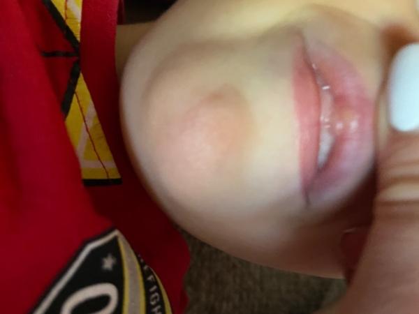 Bild zu Herpes kleinkind 3 Jahre ? - Baby Forum - Allgemeine Themen