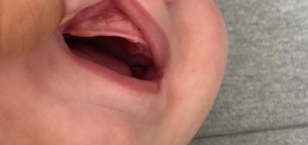 Bild zu Zähne? - Baby Forum - Allgemeine Themen