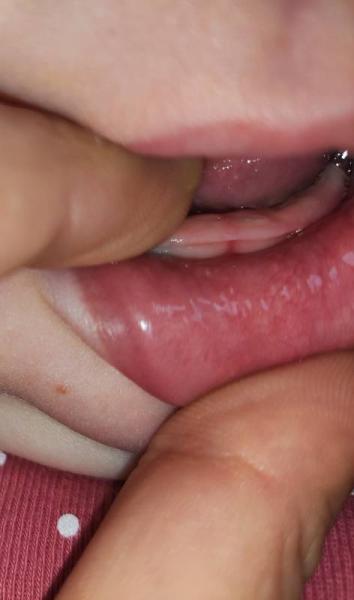 Bild zu Erster Zahn? - Baby Forum - Allgemeine Themen