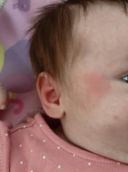 Bild zu Was sind das für Punkte & Fleck ? - Baby Forum - Allgemeine Themen