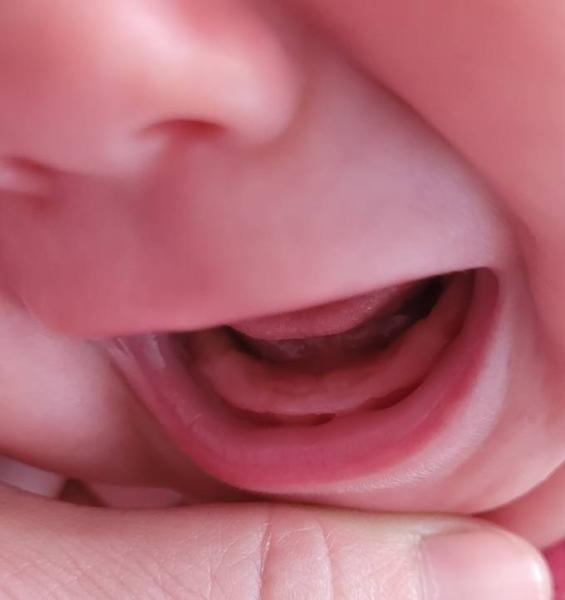 Bild zu Zahnen? - Baby Forum - Allgemeine Themen