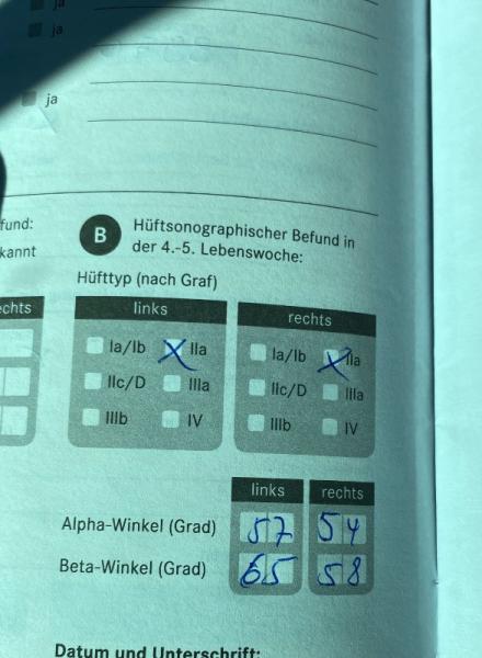 Bild zu Tübinger schiene - Baby Forum - Allgemeine Themen