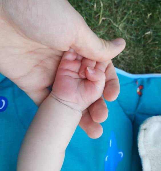 Bild zu Rote Handinnenfläche - Baby Forum - Allgemeine Themen