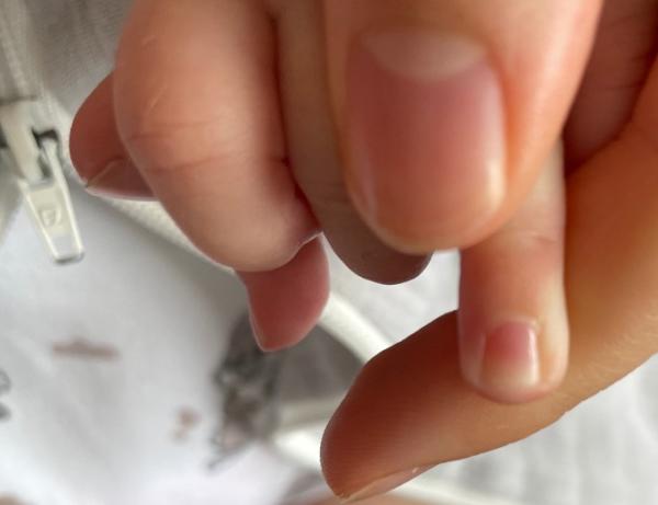 Bild zu Fingernägel evtl zu rund geschnitten. - Baby Forum - Allgemeine Themen