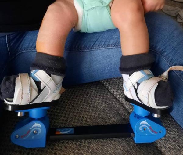Bild zu Baby (9 1/2 Wochen) schwitzt extrem stark im Schuh - Baby Forum - Allgemeine Themen