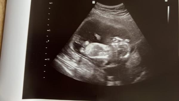 Bild zu Junge oder Mädchen? - Baby Forum - Allgemeine Themen
