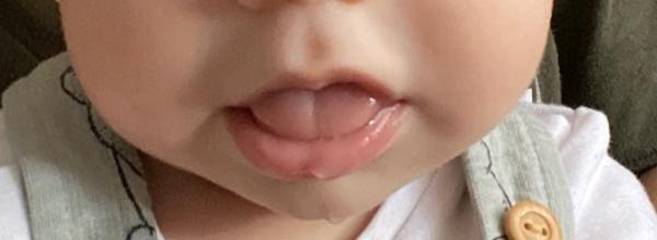 Bild zu Zunge bei 5 Monate altem Baby steht raus - Baby Forum - Allgemeine Themen