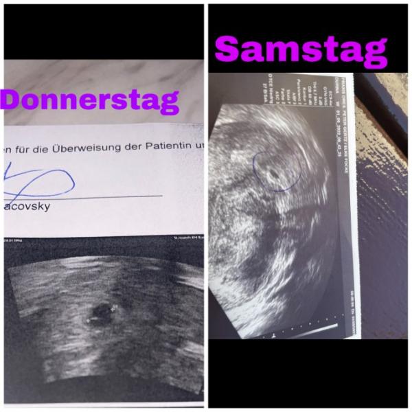 Bild zu Ssw 6+1 - Baby Forum - Allgemeine Themen