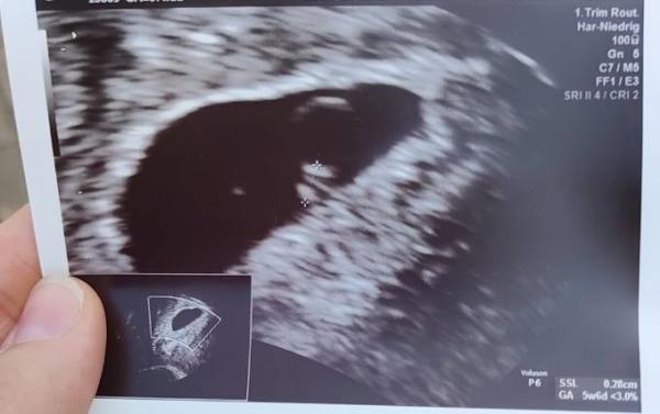 Bild zu HCG-Wert - Baby Forum - Allgemeine Themen