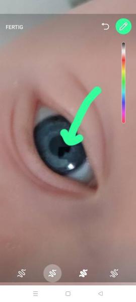 Bild zu Fehlstelle Pupille/Iris - Baby Forum - Allgemeine Themen