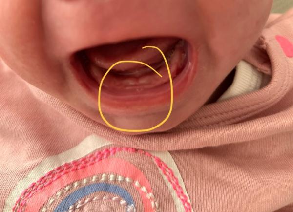 Bild zu Zahnen mit 10 Wochen - Baby Forum - Allgemeine Themen
