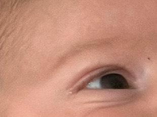 Bild zu augen - Baby Forum - Allgemeine Themen