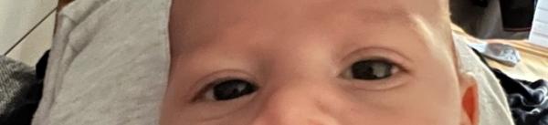 Bild zu augen - Baby Forum - Allgemeine Themen